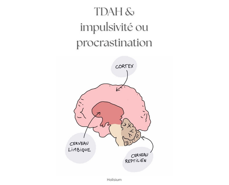 TDAH, impulsivité ou procrastination
